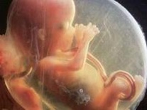 41岁卵巢早衰能做试管吗