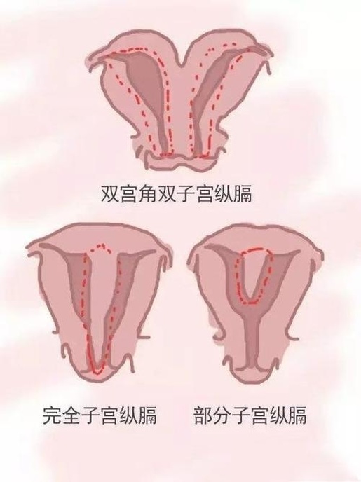 2025年无精去捷克布尔诺做试管的全部流程，从检查到移植每一